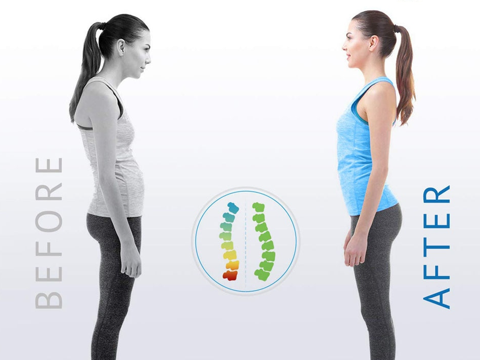 Adjustable Back Posture Corrector & Spine Support